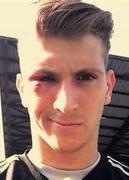 บ็อบบี อัลเลน